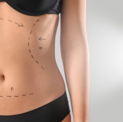 Saiba se você está pronta para uma cirurgia plástica (Foto reprodução)